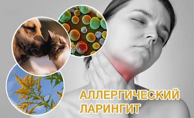 Причины, симптоматика, формы аллергического ларингита и особенности его лечения