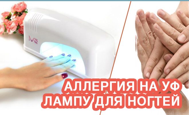 Аллергия на УФ лампу для ногтей