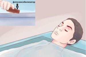 Ванны для ПУВА-терапии