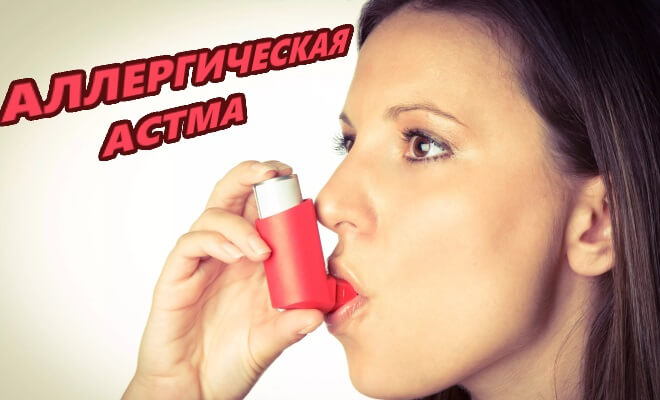 Аллергическая астма
