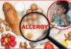 Диагностика пищевой аллергии у детей